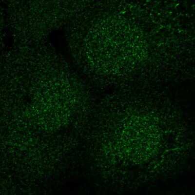 Immunocytochemistry/Immunofluorescence: SEC14L2 Antibody [NBP2-39029] - Staining of human cell line A-431 shows localization to nucleus & cytosol. Antibody staining is shown in green.