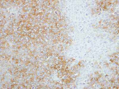 Immunohistochemistry-Paraffin: SEC14L2 Antibody [NBP2-15112] - Paraffin-embedded H1299 xenograft, using antibody at 1:100 dilution.