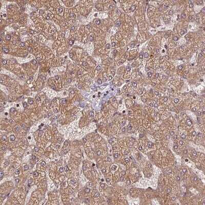 Immunohistochemistry-Paraffin: SEC14L2 Antibody [NBP2-39029] - Staining of human liver shows moderate cytoplasmic positivity in hepatocytes.