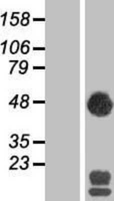 Western Blot: SEC14L2 Overexpression Lysate (Adult Normal) [NBP2-07443] Left-Empty vector transfected control cell lysate (HEK293 cell lysate); Right -Over-expression Lysate for SEC14L2.