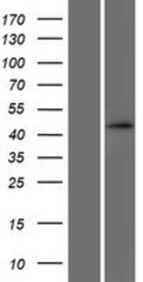 Western Blot: SEC14L4 Overexpression Lysate (Adult Normal) [NBP2-05088] Left-Empty vector transfected control cell lysate (HEK293 cell lysate); Right -Over-expression Lysate for SEC14L4.