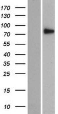 Western Blot: SEC14L5 Overexpression Lysate (Adult Normal) [NBP2-07293] Left-Empty vector transfected control cell lysate (HEK293 cell lysate); Right -Over-expression Lysate for SEC14L5.