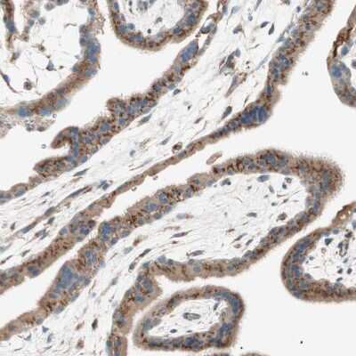 Immunohistochemistry-Paraffin: SEC16A Antibody [NBP1-83016] - Staining of human placenta shows strong cytoplasmic granular positivity in trophoblastic cells.