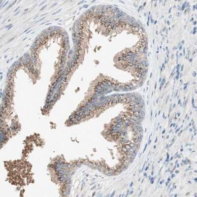 Immunohistochemistry-Paraffin: SEC16A Antibody [NBP1-83016] - Staining of human prostate shows strong cytoplasmic granular positivity in glandular cells.