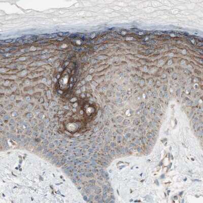 Immunohistochemistry-Paraffin: SEC16A Antibody [NBP1-83016] - Staining of human skin shows strong cytoplasmic granular positivity in squamous epithelial cells.