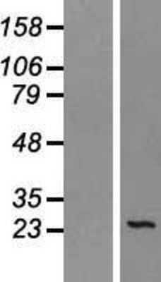 Western Blot: SEC22B Overexpression Lysate (Adult Normal) [NBP2-07813] Left-Empty vector transfected control cell lysate (HEK293 cell lysate); Right -Over-expression Lysate for SEC22B.