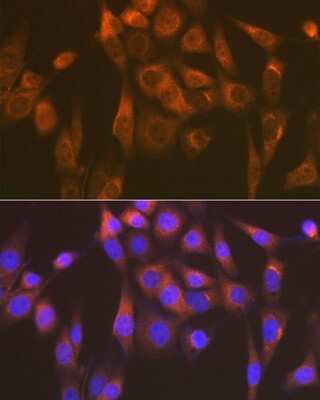 Immunocytochemistry/Immunofluorescence: SEC23A Antibody (1D4R7) [NBP3-16667] - Immunofluorescence analysis of NIH-3T3 cells using SEC23AA Rabbit mAb (NBP3-16667) at dilution of 1:100 (40x lens). Blue: DAPI for nuclear staining.