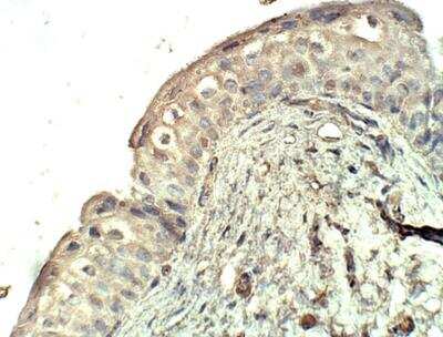 Immunohistochemistry-Paraffin: SEC23A Antibody [NBP3-12340] - Baboon Urinary Bladder. 1:100 dilution in IHC blocking buffer. DAB (brown) staining and Hematoxylin QS (blue) counterstain. 40X magnification.