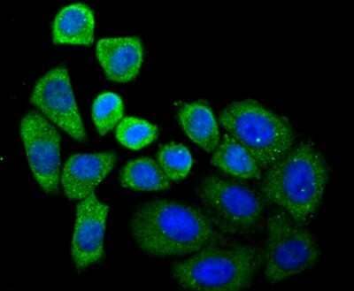 Immunocytochemistry/Immunofluorescence: SEC23A Antibody (JU37-48) [NBP2-75428] - Staining SEC23 in HepG2 cells (green). The nuclear counter stain is DAPI (blue). Cells were fixed in paraformaldehyde, permeabilised with 0.25% Triton X100/PBS.