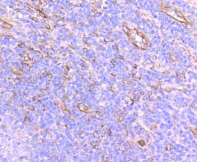 Immunohistochemistry-Paraffin: SEC23A Antibody (JU37-48) [NBP2-75428] - Analysis of paraffin-embedded human tonsil tissue using anti-SEC23 antibody. Counter stained with hematoxylin.