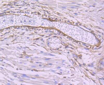 Immunohistochemistry-Paraffin: SEC23A Antibody (JU37-48) [NBP2-75428] - Analysis of paraffin-embedded human fetal skeletal muscle tissue using anti-SEC23 antibody. Counter stained with hematoxylin.