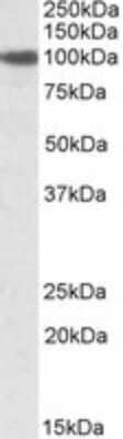 Western Blot: SEC23A Antibody [NBP1-47201] - Western blot analysis of SEC23A in NIH3T3 lysate (35ug protein in RIPA buffer) using NBP1-47201 at 2ug/ml. Primary incubation was 1 hour. Detected by chemiluminescence.