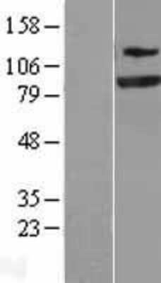 Western Blot: SEC23A Overexpression Lysate (Adult Normal) [NBL1-15777] Left-Empty vector transfected control cell lysate (HEK293 cell lysate); Right -Over-expression Lysate for SEC23A.