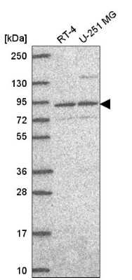 Western Blot: SEC23B Antibody [NBP2-56982] - Analysis in human cell line RT-4 and human cell line U-251 MG.