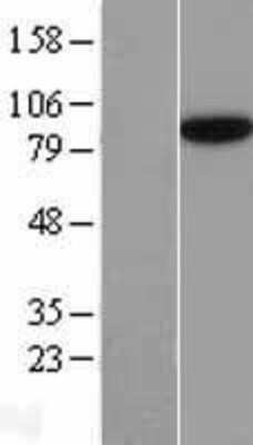 Western Blot: SEC23B Overexpression Lysate (Adult Normal) [NBL1-15778] Left-Empty vector transfected control cell lysate (HEK293 cell lysate); Right -Over-expression Lysate for SEC23B.