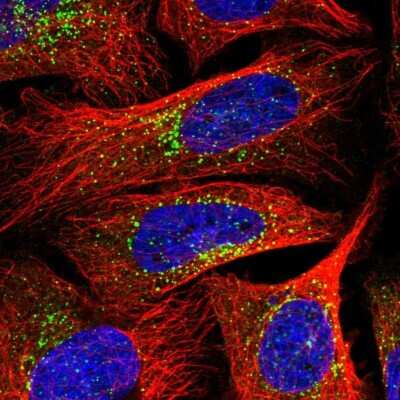 <b>Independent Antibodies Validation. </b>Immunocytochemistry/Immunofluorescence: SEC23IP Antibody [NBP2-58361] - Staining of human cell line U-2 OS shows localization to vesicles.