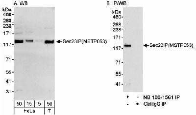 Western Blot: SEC23IP Antibody [NB100-1561] - Detection of Human Sec23IP(MSTP053) on HeLa whole cell lysate using NB100-1561.