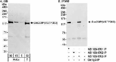 Western Blot: SEC23IP Antibody [NB100-1563] - Detection of Human Sec23IP(MSTP053) on HeLa whole cell lysate using NB100-1563. Sec23IP(MSTP053) was also immunoprecipitated using rabbit anti-Sec23IP(MSTP053) antibodies NB100-1561 and NB100-1562.