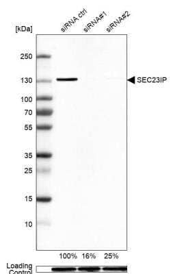 <b>Genetic Strategies Validation. </b>Western Blot: SEC23IP Antibody [NBP2-58361] - Analysis in A-549 cells transfected with control siRNA, target specific siRNA probe #1 and #2. Remaining relative intensity is presented. Loading control: Anti-GAPDH.