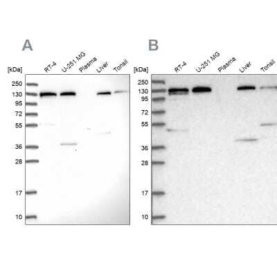 Western Blot: SEC23IP Antibody [NBP2-58361] - Analysis using Anti-SEC23IP antibody NBP2-58361 (A) shows similar pattern to independent antibody NBP1-82456 (B).