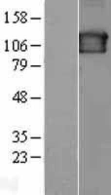 Western Blot: SEC23IP Overexpression Lysate (Adult Normal) [NBL1-15780] Left-Empty vector transfected control cell lysate (HEK293 cell lysate); Right -Over-expression Lysate for SEC23IP.