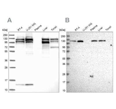 <b>Independent Antibodies Validation and Orthogonal Strategies Validation.</b>Western Blot: SEC24C Antibody [NBP1-81550] - Analysis using Anti-SEC24C antibody NBP1-81550 (A) shows similar pattern to independent antibody NBP1-81549 (B).