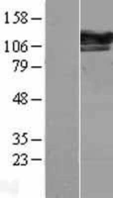 Western Blot SEC24D Overexpression Lysate