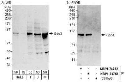 Immunoprecipitation: SEC3 Antibody [NBP1-78752] - Whole cell lysate from HeLa (15 and 50 mcg for WB; 1 mg for IP, 20% of IP loaded), 293T (T; 50 mcg), Jurkat (J; 50 mcg) and mouse NIH3T3 (M; 50 mcg) cells.  Antibodies: Affinity purified rabbit anti-Sec3 antibody used for WB at 0.1 mcg/ml (A) and 1 mcg/ml (B) and used for IP at 6 mcg/mg lysate.  Sec3 was also immunoprecipitated by rabbit anti-Sec3 antibody NBP1-78753 which recognizes a downstream epitope.