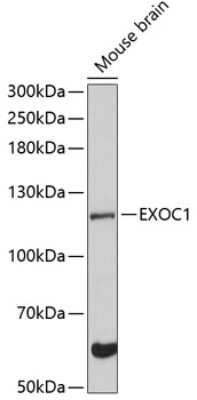 Western Blot: SEC3 Antibody [NBP2-94814] - Analysis of extracts of mouse brain, using SEC3 at 1:3000 dilution.Secondary antibody: HRP Goat Anti-Rabbit IgG (H+L) at 1:10000 dilution.Lysates/proteins: 25ug per lane.Blocking buffer: 3% nonfat dry milk in TBST.Detection: ECL Basic Kit .Exposure time: