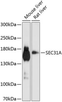Western Blot: SEC31A Antibody [NBP2-93172] - Analysis of extracts of various cell lines, using SEC31A at 1:1000 dilution. Secondary antibody: HRP Goat Anti-Rabbit IgG (H+L) at 1:10000 dilution. Lysates/proteins: 25ug per lane. Blocking buffer: 3% nonfat dry milk in TBST. Detection: ECL Basic Kit . Exposure time: 15s.