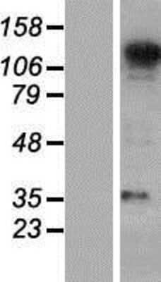 Western Blot: SEC31A Overexpression Lysate (Adult Normal) [NBP2-08450] Left-Empty vector transfected control cell lysate (HEK293 cell lysate); Right -Over-expression Lysate for SEC31A.