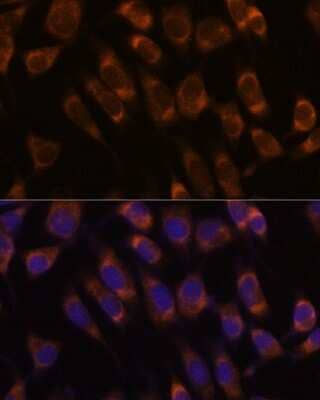 Immunocytochemistry/Immunofluorescence: SEC61B Antibody [NBP2-93984] - Analysis of L929 cells using SEC61B at dilution of 1:100. Blue: DAPI for nuclear staining.