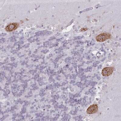 Immunohistochemistry-Paraffin: SEC61B Antibody [NBP2-13290] - Staining of human cerebellum shows moderate to strong positivity in endoplasmic reticulum in Purkinje cells.