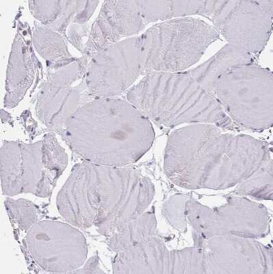 Immunohistochemistry-Paraffin: SEC61B Antibody [NBP2-13290] - Staining of human skeletal muscle shows no positivity in myocytes as expected.