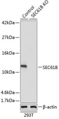 <b>Genetic Strategies Validation. </b>Western Blot: SEC61B Antibody [NBP2-93984] - Analysis of extracts from normal (control) and SEC61B knockout (KO) 293T cells, using SEC61B at 1:1000 dilution.Secondary antibody: HRP Goat Anti-Rabbit IgG (H+L) at 1:10000 dilution.Lysates/proteins: 25ug per lane.Blocking buffer: 3% nonfat dry milk in T