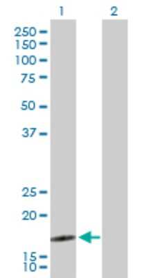 Western Blot: SEC61B Antibody [H00010952-D01P] - Analysis of SEC61B expression in transfected 293T cell line by SEC61B polyclonal antibody.Lane 1: SEC61B transfected lysate(10.00 KDa).Lane 2: Non-transfected lysate.