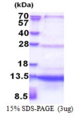 SDS-Page: SEC61B Protein [NBP2-23455]