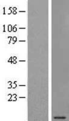 Western Blot: SEC61G Overexpression Lysate (Adult Normal) [NBP2-09141] Left-Empty vector transfected control cell lysate (HEK293 cell lysate); Right -Over-expression Lysate for SEC61G.