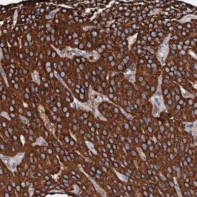 Immunohistochemistry: SECISBP2L Antibody [NBP1-81530] - Staining of human parathyroid gland shows cytoplasmic positivity in glandular cells.