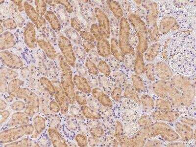 Immunohistochemistry-Paraffin SECISBP2L Antibody - BSA Free