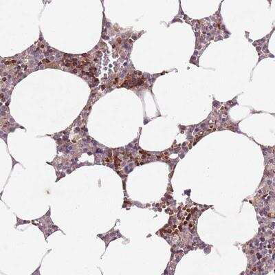 Immunohistochemistry-Paraffin: SECTM1 Antibody [NBP2-13292] - Staining of human bone marrow shows strong cytoplasmic positivity in subset of hematopoietic cells.