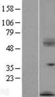 Western Blot: SECTM1 Overexpression Lysate (Adult Normal) [NBP2-08051] Left-Empty vector transfected control cell lysate (HEK293 cell lysate); Right -Over-expression Lysate for SECTM1.