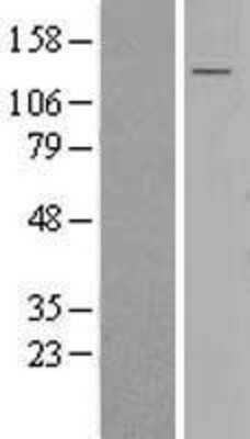 Western Blot: SEL1L3 Overexpression Lysate (Adult Normal) [NBL1-12254] Left-Empty vector transfected control cell lysate (HEK293 cell lysate); Right -Over-expression Lysate for SEL1L3.