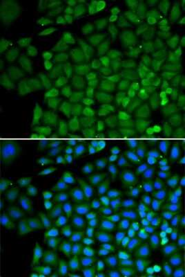 Immunocytochemistry/Immunofluorescence: SELENBP1 Antibody [NBP3-03603] - Analysis of HeLa cells using SELENBP1 antibody . Blue: DAPI for nuclear staining.