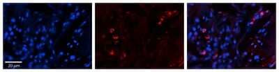 Immunohistochemistry: SELENBP1 Antibody [NBP1-55263] - Formalin Fixed Paraffin Embedded Tissue: Human Lung Tissue Observed Staining: Cytoplasmic, membrane and nuclear in alveolar type I & II cells Primary Antibody Concentration: 1:100 Other Working Concentrations: 1/600 Secondary Antibody: Donkey anti-Rabbit-Cy3 Secondary Antibody Concentration: 1:200 Magnification: 20X Exposure Time: 0.5 - 2.0 sec