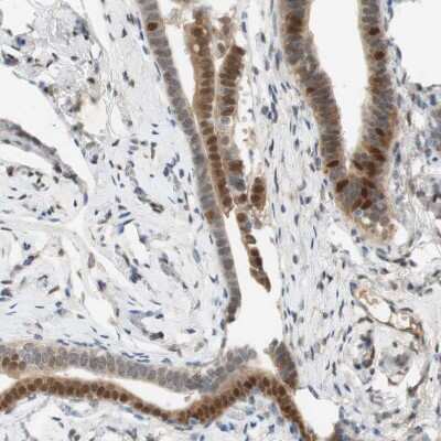 Immunohistochemistry: SELENBP1 Antibody [NBP1-83196] - Staining of human Fallopian tube shows weak to moderate nuclear positivity in glandular cells.