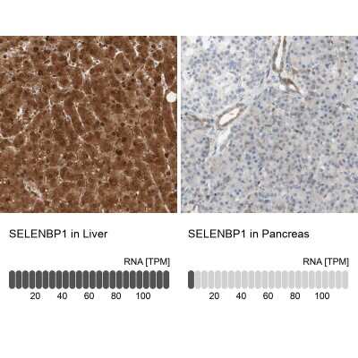 <b>Orthogonal Strategies Validation. </b>Immunohistochemistry-Paraffin: SELENBP1 Antibody [NBP1-83196] - Staining in human liver and pancreas tissues using anti-SELENBP1 antibody. Corresponding SELENBP1 RNA-seq data are presented for the same tissues.