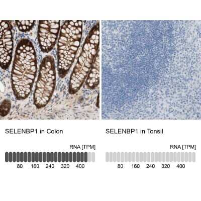 <b>Orthogonal Strategies Validation. </b>Immunohistochemistry-Paraffin: SELENBP1 Antibody [NBP1-83196] - Analysis in human colon and tonsil tissues. Corresponding SELENBP1 RNA-seq data are presented for the same tissues.