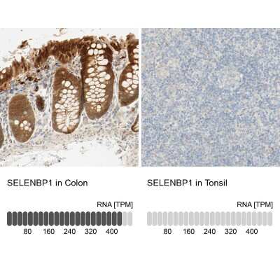 <b>Orthogonal Strategies Validation. </b>Immunohistochemistry-Paraffin: SELENBP1 Antibody [NBP1-83197] - Analysis in human colon and tonsil tissues. Corresponding SELENBP1 RNA-seq data are presented for the same tissues.