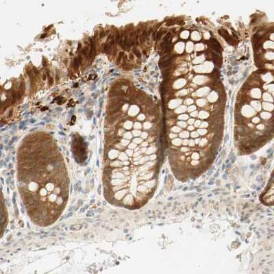 Immunohistochemistry-Paraffin: SELENBP1 Antibody [NBP1-83197] - Staining of human colon shows strong cytoplasmic positivity in glandular cells.